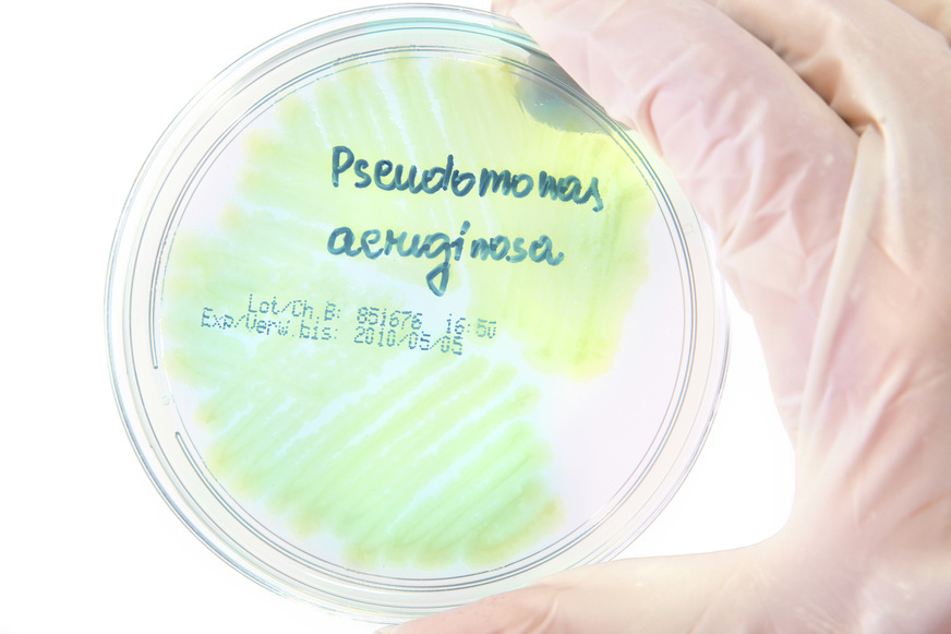 Das Bakterium Pseudomonas aeruginosa (PSA) in einer Petrischale