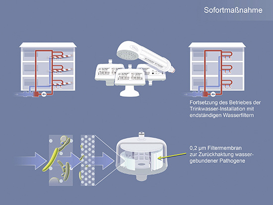 Bei einer Kontamination der Trinkwasser-Installation mit Legionellen kann der Einsatz endständiger Wasserfilter eine überbrückende Notfallmaßnahme sein