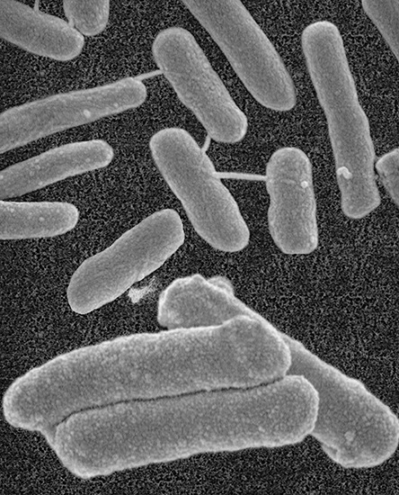 E-Coli und Legionella unter dem Mikroskop