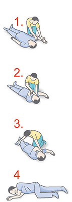 Vorgehensweise zur stabilen Seitenlage:
1.) Beine des Bewusstlosen strecken. Den nahen Arm des Bewusstlosen angewinkelt nach oben legen.
2.) Die ferne Hand des Bewusstlosen fassen und den Arm vor der Brust kreuzen. Die Hand nicht loslassen.
3.) Mit der anderen Hand an den fernen Oberschenkel des Bewusst­losen greifen und das Bein beugen.
4.) Den Bewusstlosen zu sich herüber ziehen. Den Hals überstrecken und den Mund leicht öffnen. Die an der Wange liegende Hand des Bewusstlosen so ausrichten, dass der Hals überstreckt bleibt.
5.) Ständige Atemkontrolle des Bewusstlosen, Notuf 112.