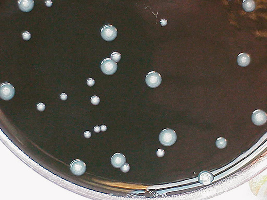 Auf einem Nährboden können sich kleine, zählbare Kolonien von Legionellen 
bilden die so genannten KBE
