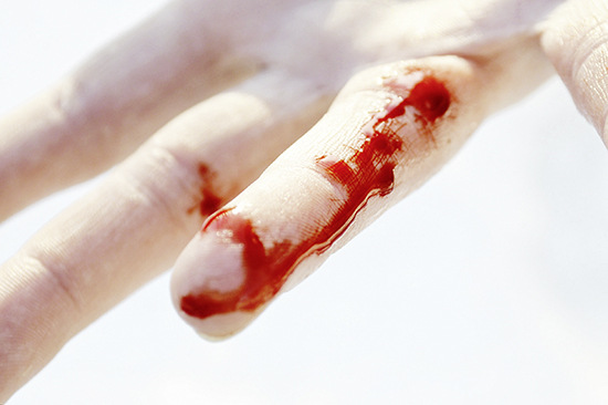 Die Wunde selbst ruft für jeden Betroffenen eine Reihe von ­Reaktionen hervor. Lesen Sie, was im Falle einer Verletzung ­während der Arbeit sinnvoll ist